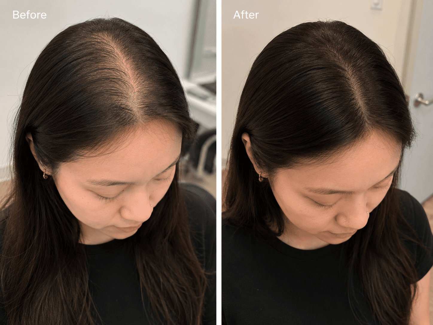 Scalp Recovery